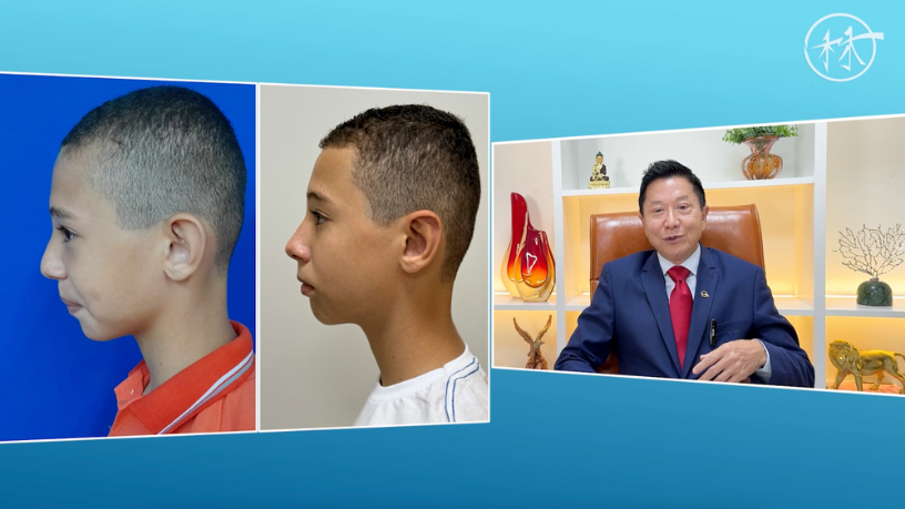 Descubra com Milton Seigi Hayashi os limites entre saúde e exagero nas transformações estéticas online.